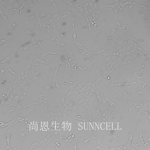 HBL-100(人整合SV40基因的乳腺上皮细胞)