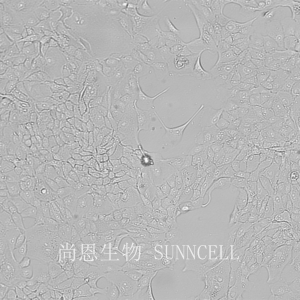 MDCK[NBL-2](狗肾细胞)