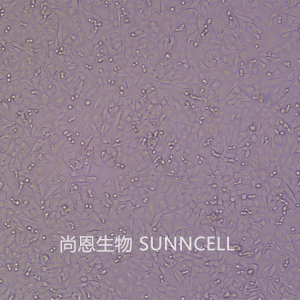A-375(人恶性黑色素瘤细胞)(STR鉴定正确)
