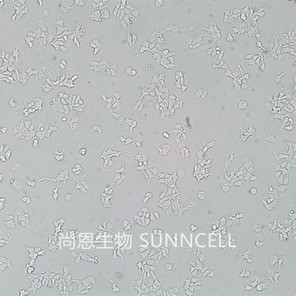 22RV1(人前列腺癌细胞)