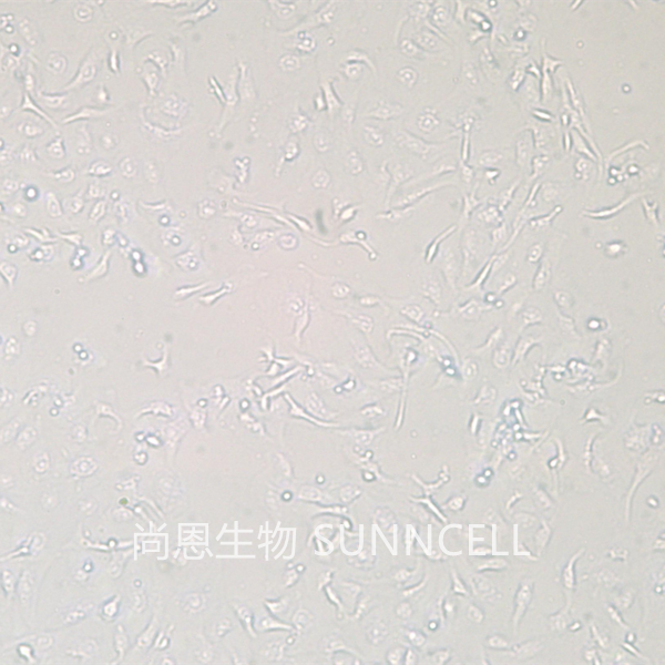 HCCC-9810(人胆管细胞型肝癌细胞)