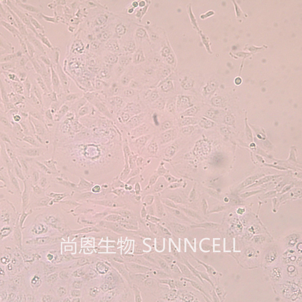 HuH-6(人肝母细胞瘤细胞)
