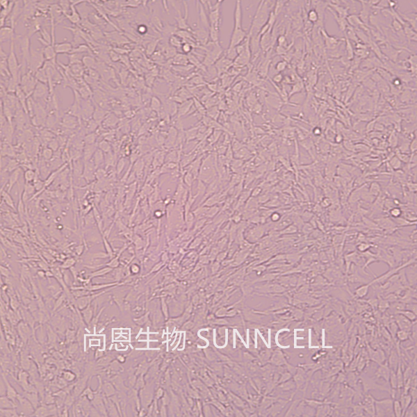 U-118 MG(人脑星形胶质母细胞瘤)