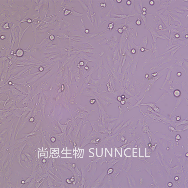 U251(人胶质瘤细胞)
