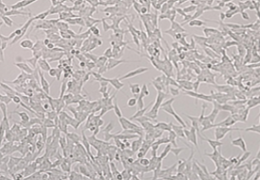 细胞培养形态与ATCC等官网照片有点区别正常吗？