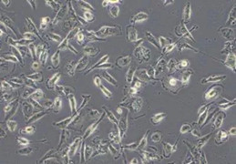 细胞有小颗粒或疑似细菌污染怎么处理？