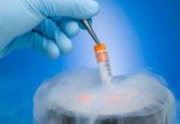 冻存细胞用的冻存液配方建议使用哪种？