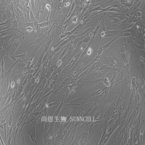 HFL1(人胚肺成纤维细胞)(STR鉴定正确)(暂不出售)