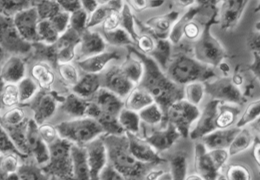 细胞攻略 | Hepa1-6(小鼠肝癌细胞)培养教程