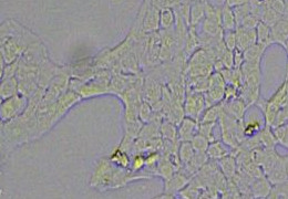 细胞攻略 | MCF 10A(人正常乳腺上皮细胞)