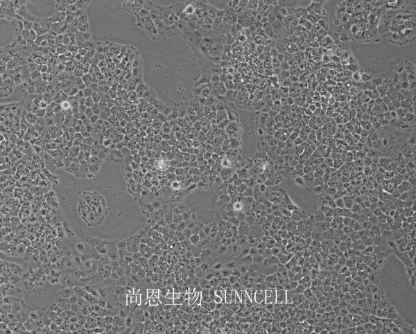 NCI-H292(人肺癌细胞(淋巴结转移))