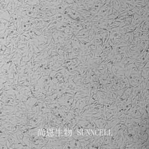 A172(人胶质母细胞瘤细胞)