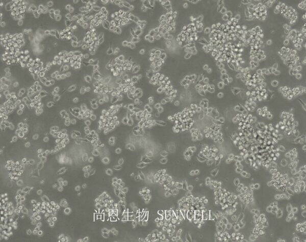 SNU-1(人胃癌细胞)