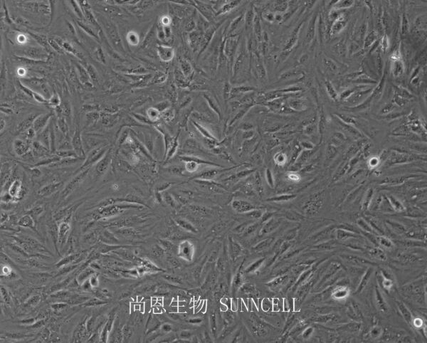 SNU-387(人肝癌细胞)