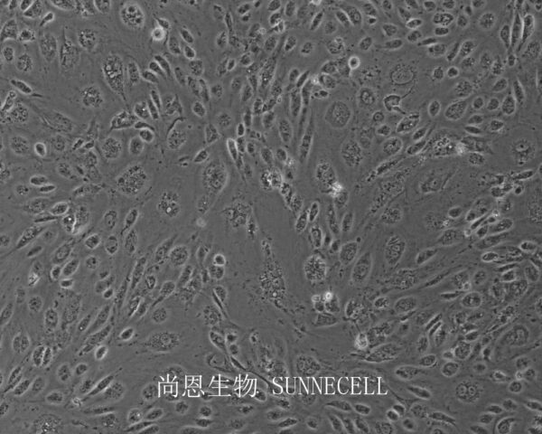 HMEC-1(人微血管内皮细胞)(暂不出售)