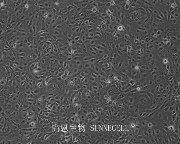HMEC-1(人微血管内皮细胞)(暂不出售)