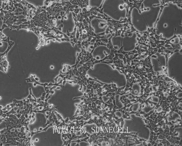 MIN6(小鼠胰岛瘤细胞)(暂不出售)