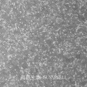 DMS114(人小细胞肺癌细胞)