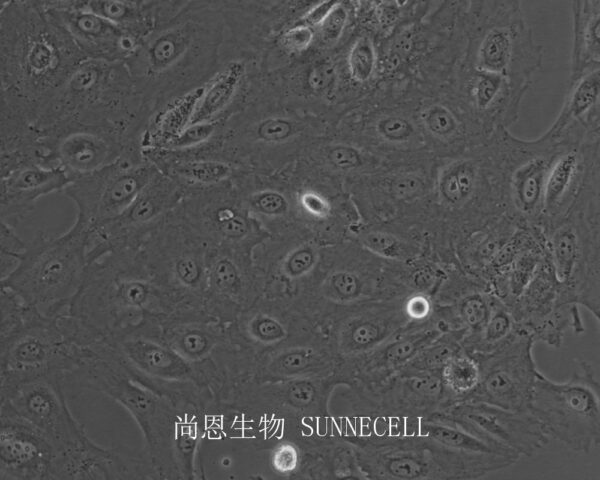 SNU-182(人肝癌细胞)