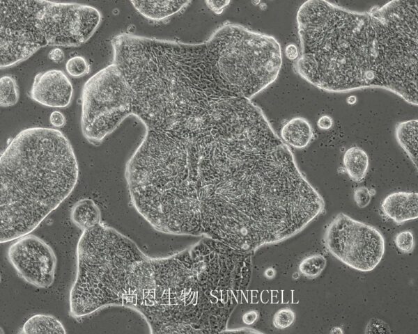 SW1116(人结肠腺癌细胞)