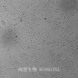 SW-13(人肾上腺皮质小细胞癌细胞)