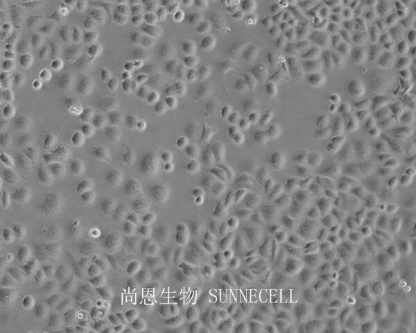 SW-13(人肾上腺皮质小细胞癌细胞)