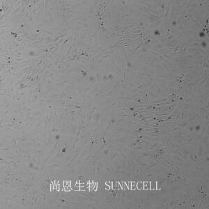SW 982 [SW-982, SW982](人滑膜肉瘤细胞)