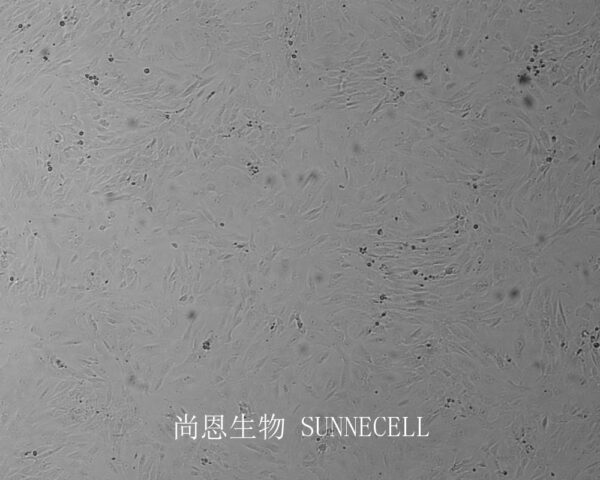 SW 982 [SW-982, SW982](人滑膜肉瘤细胞)