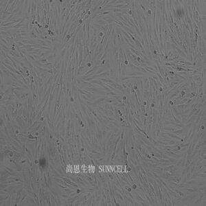 SF126(人胶质母细胞瘤细胞)