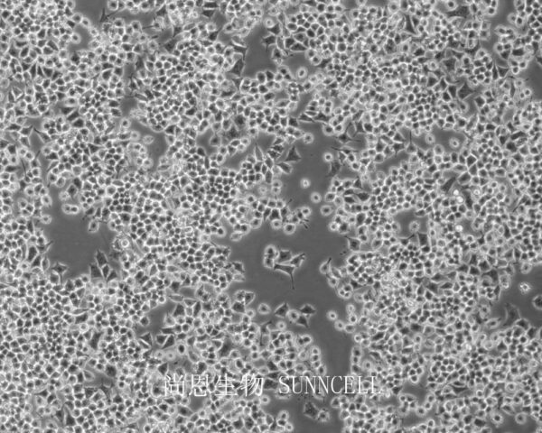 RIN-m5F(大鼠β胰岛素瘤细胞)