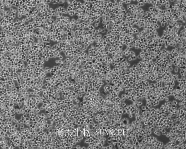 RIN-m5F(大鼠β胰岛素瘤细胞)
