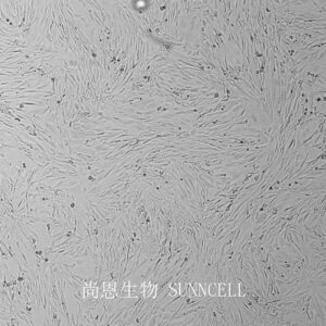 HSF(SV40)(人包皮成纤维细胞)