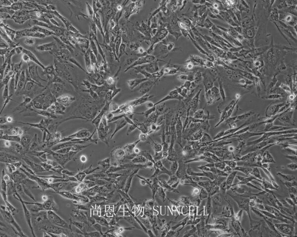 HEEpiC-SV40[暂不提供](人子宫内膜上皮细胞永生化)(暂不出售)