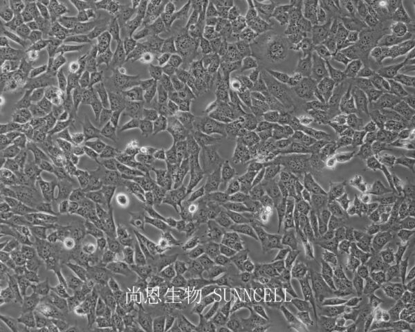 C17.2(小鼠神经干细胞)