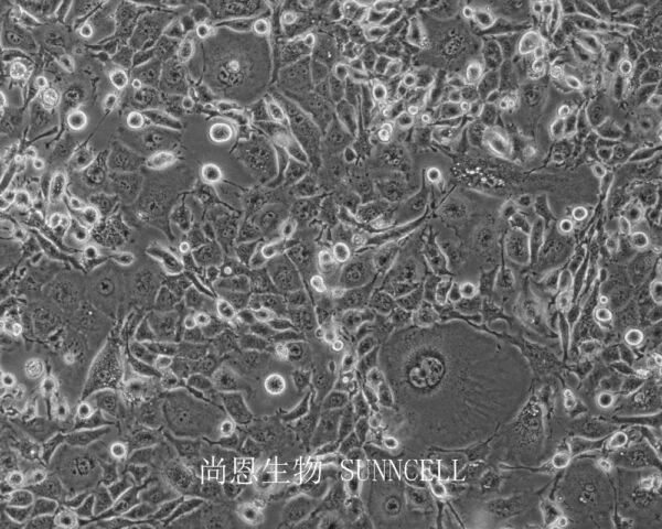 GL261+luc(小鼠胶质细胞瘤细胞（luc标记）)