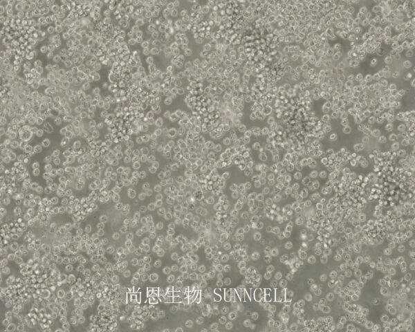SU-DHL-2(人B细胞淋巴瘤细胞)