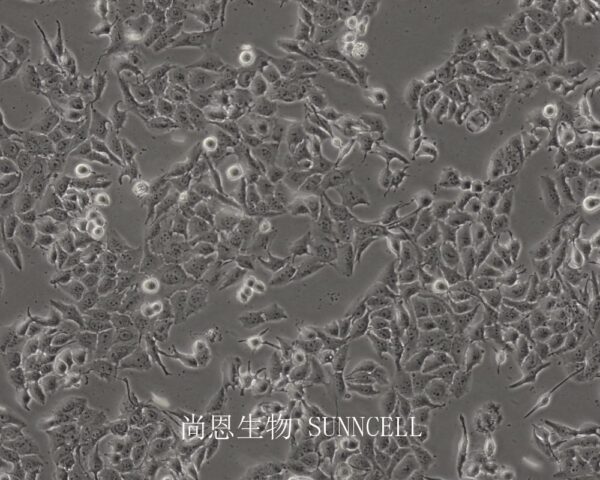 NCI-H3122(人非小细胞肺癌细胞)