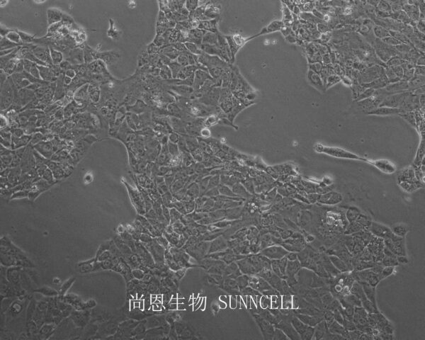 OE33(人食管腺癌细胞)
